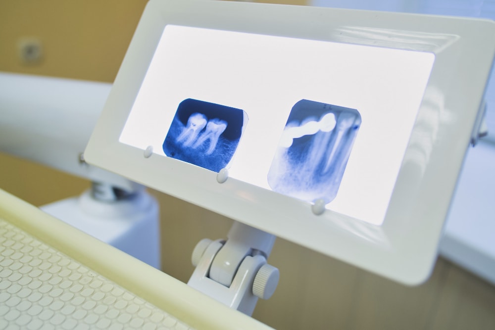 enhance patient engagement with dental digital signage